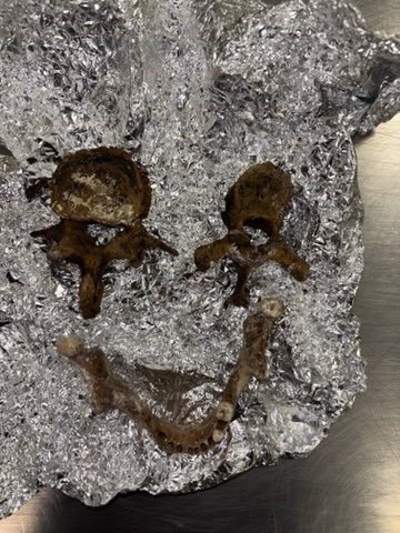 Airport staff have found bones in one traveller's luggage.