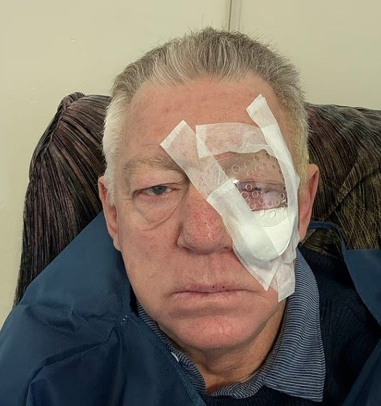 Phil Gould sporting his eye patch.