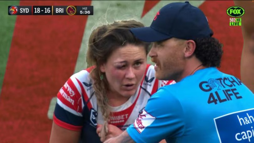 Keely Davis copped a heavy hit in the dying minutes. 