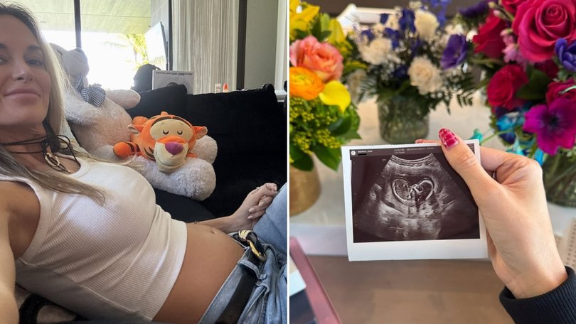Brooks Koepka’s wife Jena Sims has shared that she suffered a miscarriage at 16 weeks.