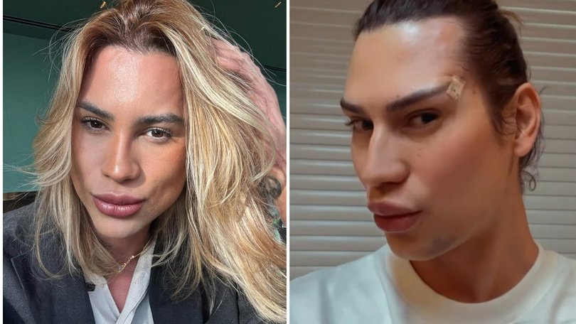 Influencer dies after cat-eye surgery.