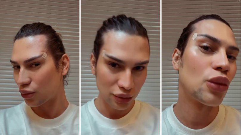The influencer shared a video just after the surgery.