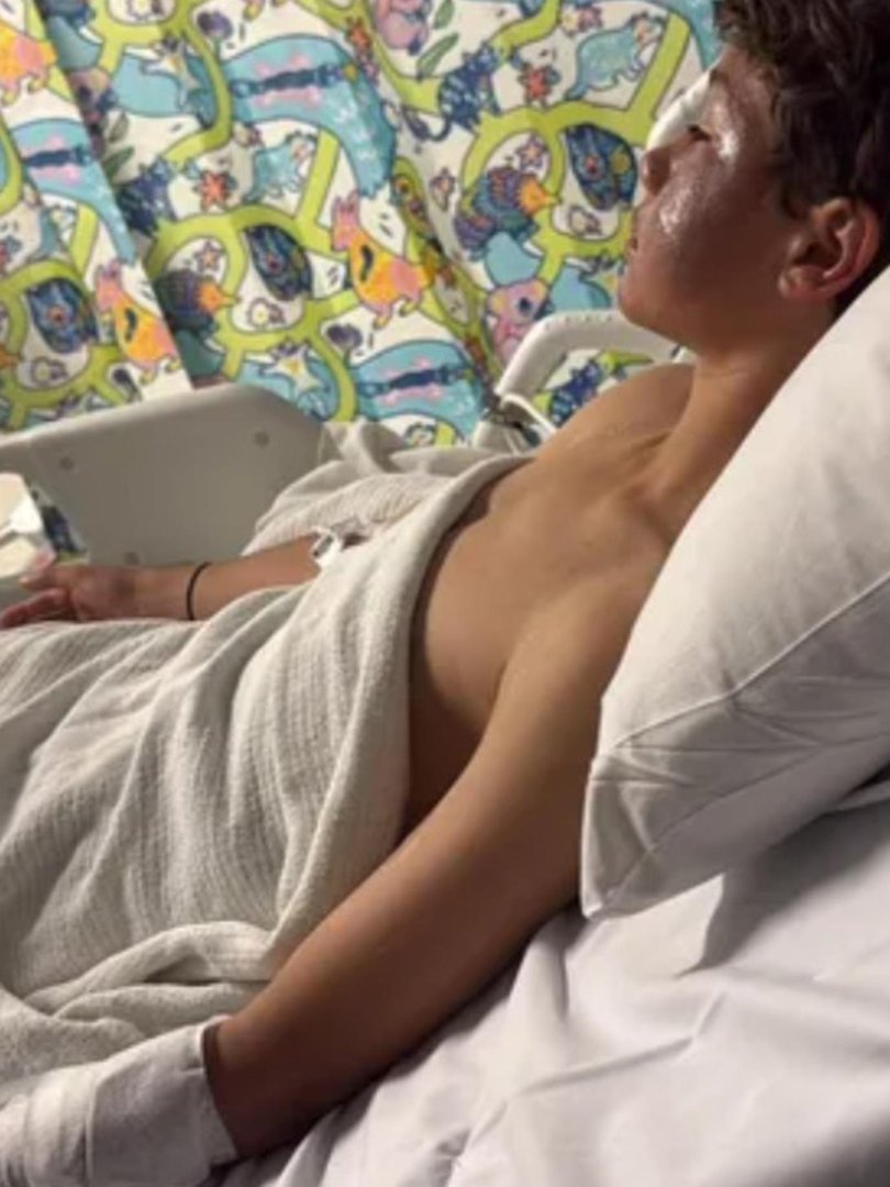 Lucas was badly burnt in the incident. 