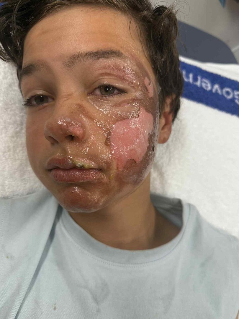 The most severe injuries are to his face.