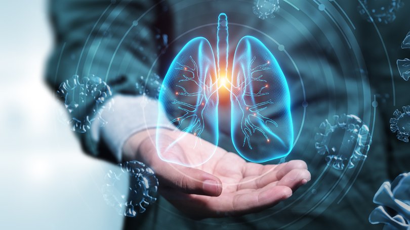$1.1 billion ASX lung imaging company 4D Medical filed a claim for $24 million in damages against Cyclopharm in the Victorian Supreme Court.