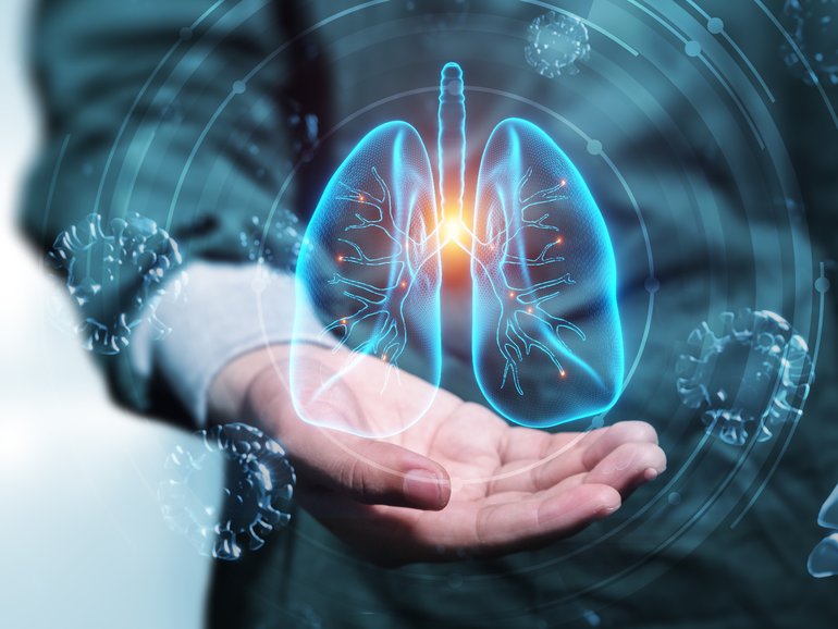 $1.1 billion ASX lung imaging company 4D Medical filed a claim for $24 million in damages against Cyclopharm in the Victorian Supreme Court.