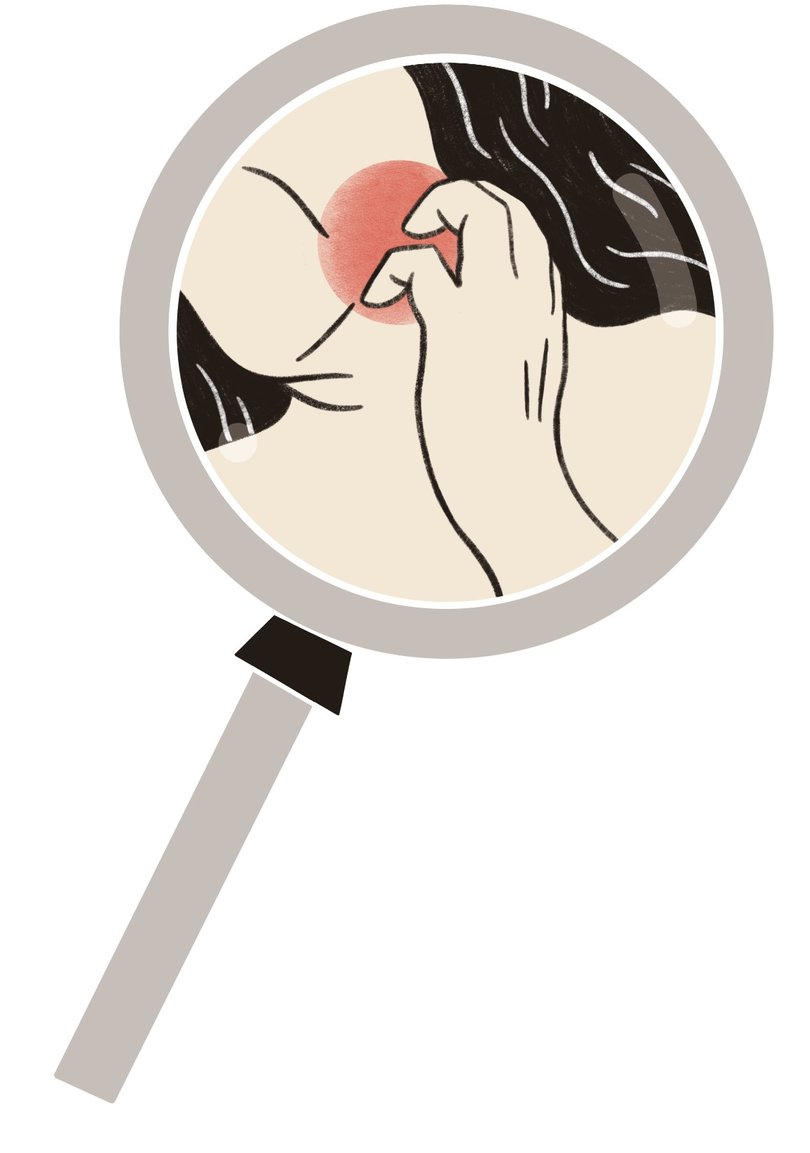 Dermatologists say scratching is a bad idea.