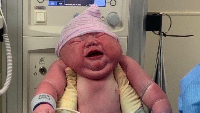 Baby Cassian, soon after being born.