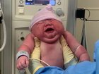 Baby Cassian, soon after being born.