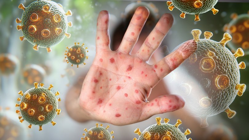 Measles Vaccine
llustration: Don Lindsay