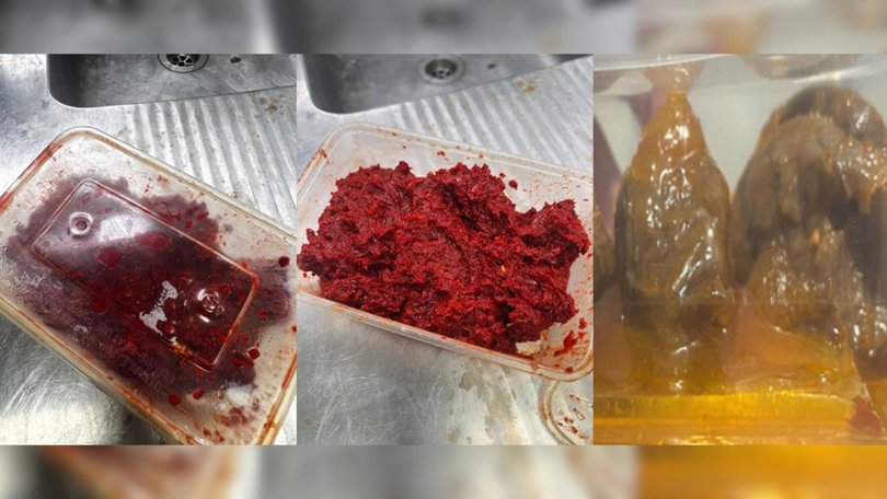 Queensland Health has asked anyone who may be in possession of these items to immediately throw them in the bin.