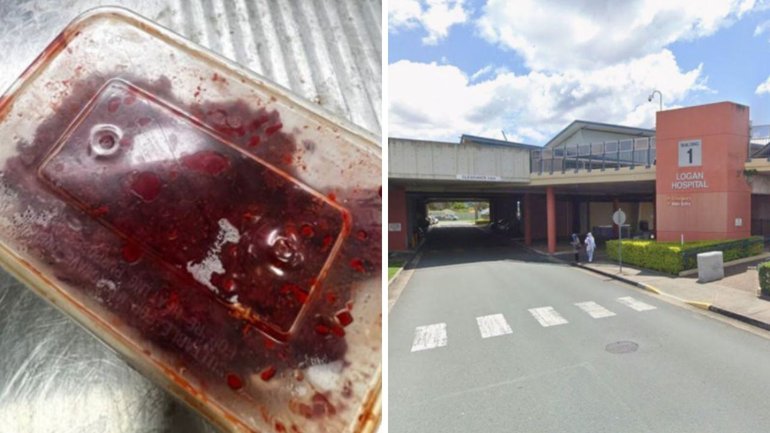 Health authorities in Queensland have issued an urgent warning after identifying the likely products linked to a case of poisonings.