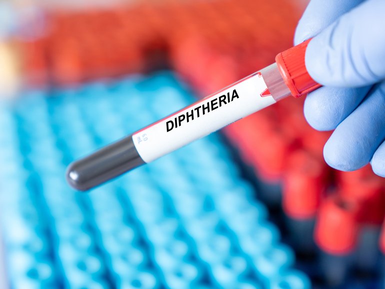 Once a vanquished child killer, Diptheria has returned..