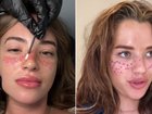 Freckle tattoos: Sun-kissed staple or beauty trend gone too far?