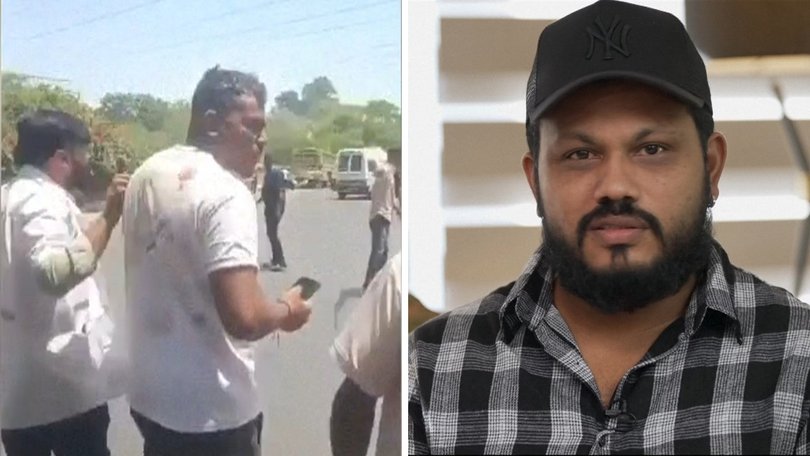 Vishwash Kumar Ramesh was the sole survivor of an Air India plane crash that killed 260 people.