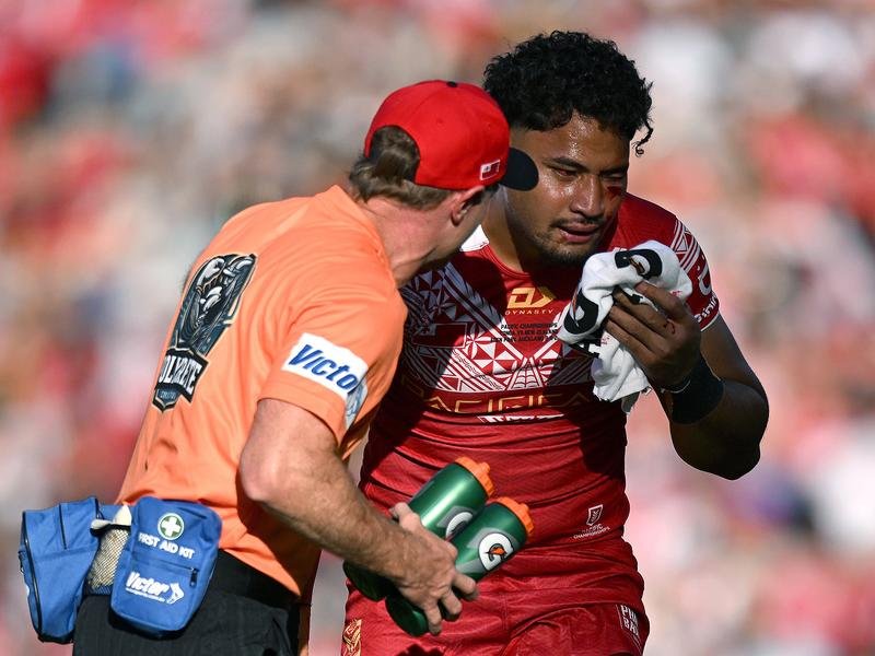 Tonga's Eliesa Katoa remains in hospital after a series of head knocks in the Pacific Cup. 