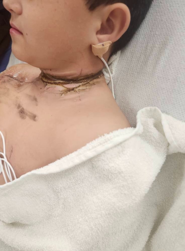 Lorenzo's necklace ignited instantly when it slipped into a gap between a loosely connected extension cord and phone charger.