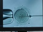 A sperm donor has passed on a cancer-causing gene. 