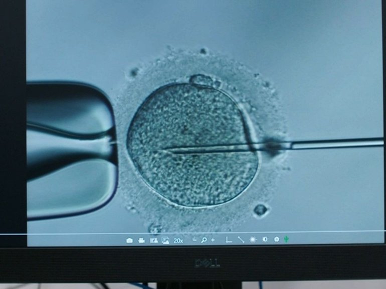 A sperm donor has passed on a cancer-causing gene. 