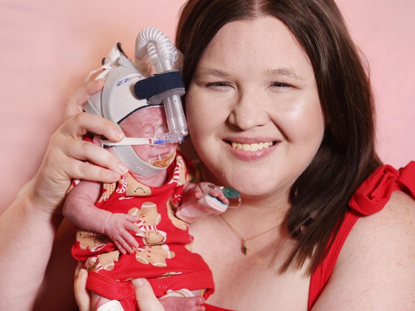 Charlie weighs barely a tenth of the average of a newborn baby boy and is believed to be Queensland’s smallest ever baby.