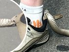 A reptile catcher who was called out to help paramedics with a possible snake bite was left stunned when faced with a Eastern Brown Snake that ended up in a place he ‘still can’t quite believe’.