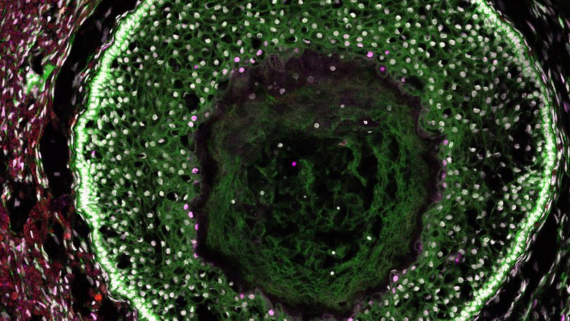 A day 70 ovarian organoid, developed from human-induced pluripotent stem cells, shows resemblance to human ovarian follicles. 