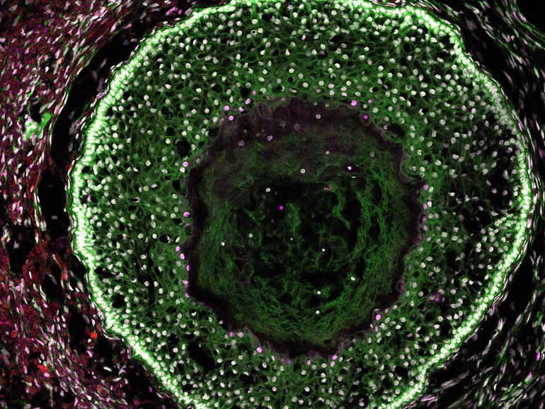 A day 70 ovarian organoid, developed from human-induced pluripotent stem cells, shows resemblance to human ovarian follicles. 