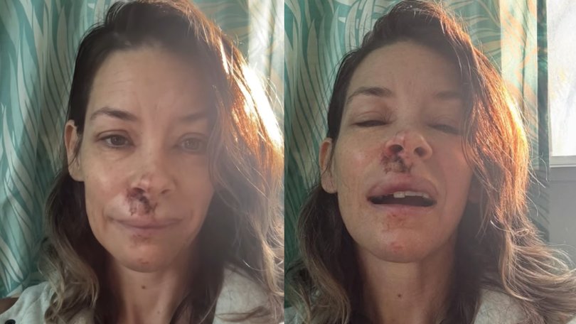 Lilly was taken to hospital for treatment after a fall.