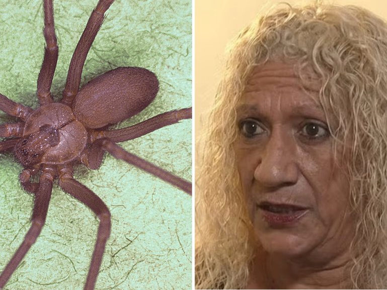A woman is taking legal action after her landlord allegedly ignored a venomous spider plague, costing her two toes and her home.