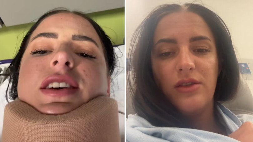 An Aussie woman has issued a warning for others after a popular hair accessory left her with a serious head injury after a crash.
