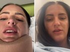 An Aussie woman has issued a warning for others after a popular hair accessory left her with a serious head injury after a crash.