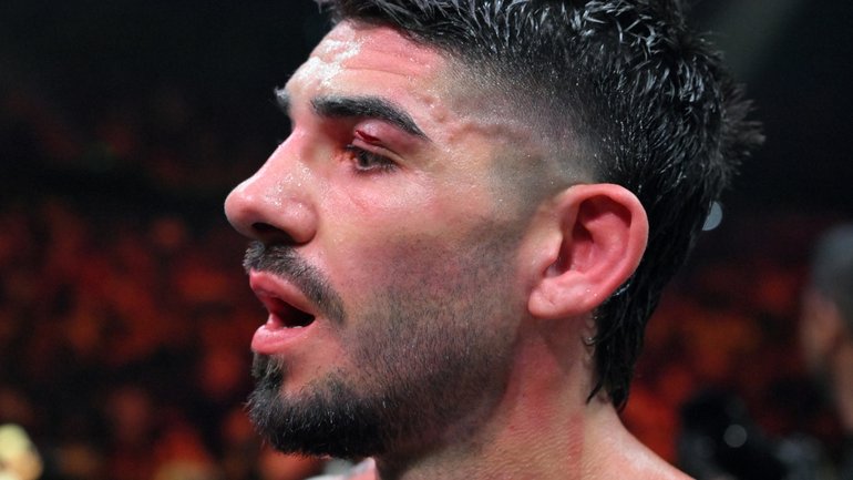 Michael Zerafa has apologised for the controversial finish to his bout with Nikita Tszyu.