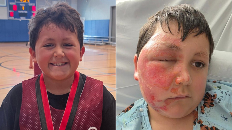 Caleb Chabolla before and after microwaving the NeeDoh.