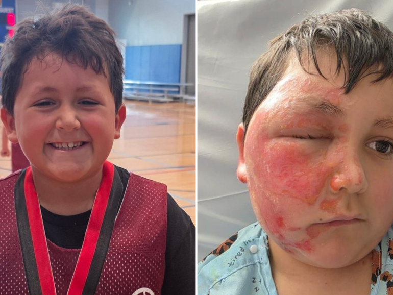 Caleb Chabolla before and after microwaving the NeeDoh.