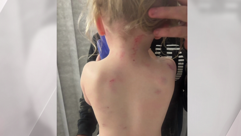 The little girl suffered injuries to her head, neck and back.