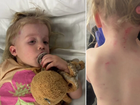 Claire Gaiter claimed staff from Goodstart Early Learning in Echuca called to say her daughter Matilda had been hit with a shovel on Wednesday morning.