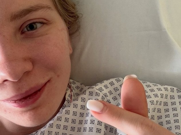 Kamila Sellier is on the mend after undergoing surgery on her injured face.