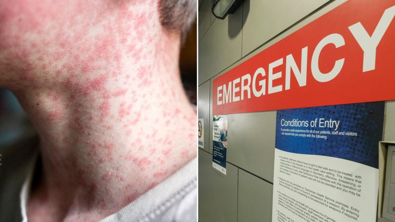 A measles alert has been issued for western Sydney