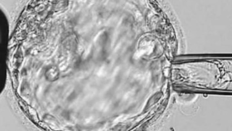 Investors were advised insurers would cover costs for both claims in the company’s half yearly report to the Australian Stock Exchange. Picture: Supplied