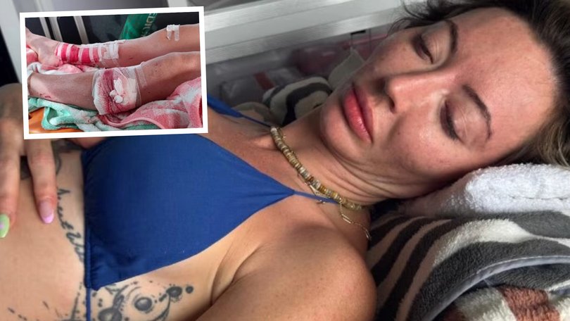 A Queensland woman’s idyllic holiday has turned into a nightmare after a makeshift platform collapsed beneath her during a boat tour in the Philippines, leaving her pinned under concrete in the water.

