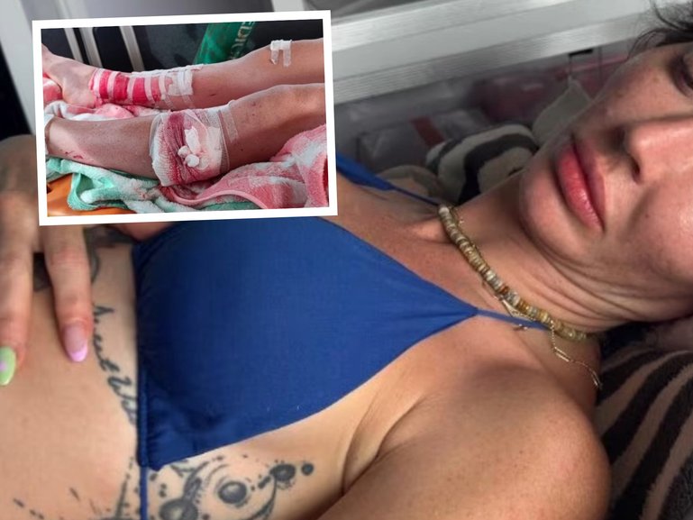 A Queensland woman’s idyllic holiday has turned into a nightmare after a makeshift platform collapsed beneath her during a boat tour in the Philippines, leaving her pinned under concrete in the water.

