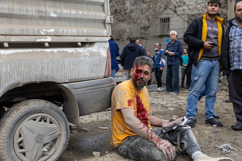 An injured man rests against a vehicle following a strike on a residential building on Monday in central Tehran.