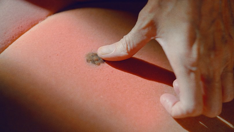 mycar Tyre & Auto have launched a car with a skin-like interior that can get sunburnt when exposed to harmful UV rays. Supplied by mycar Tyre & Auto Picture: Unknown