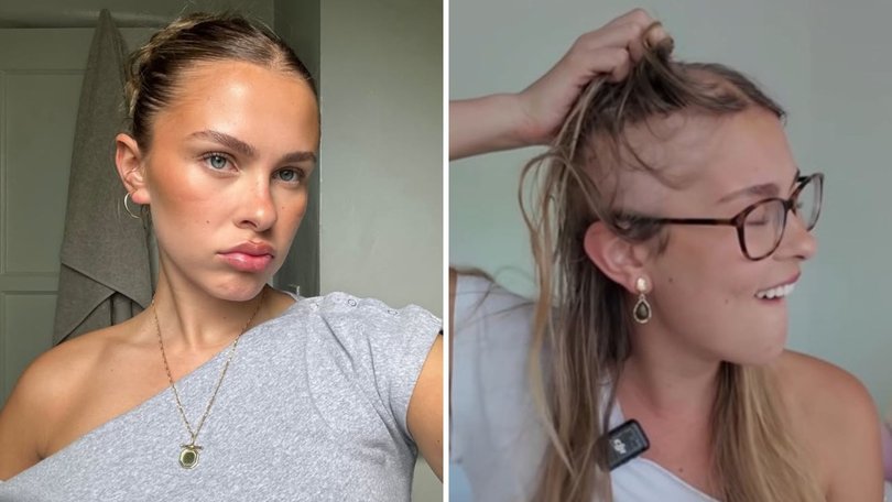 Australian actor Alea O’Shea has been bravely battling brain cancer as a young woman since November.