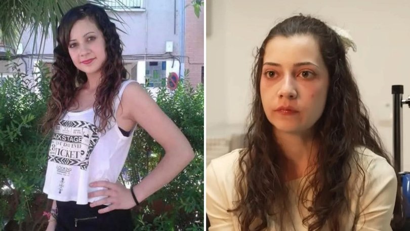 The death of a young woman who chose to die after being paralysed has attracted global attention.