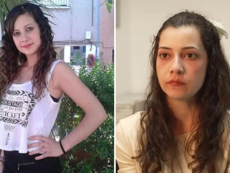 The death of a young woman who chose to die after being paralysed has attracted global attention.