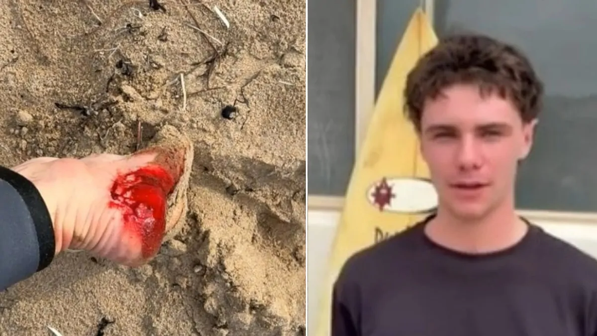 South Australia shark attack victim, Oliver Tokic-Bensley, has lucky escape while surfing in Middleton South Australia shark attack victim, Oliver Tokic-Bensley, has lucky escape while surfing in Middleton
