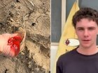 The teenager had a lucky escape after a shark attack.