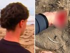 A 16-year-old surfer said he was lucky to escape serious injury after a shark reportedly bit his foot over the Easter weekend.