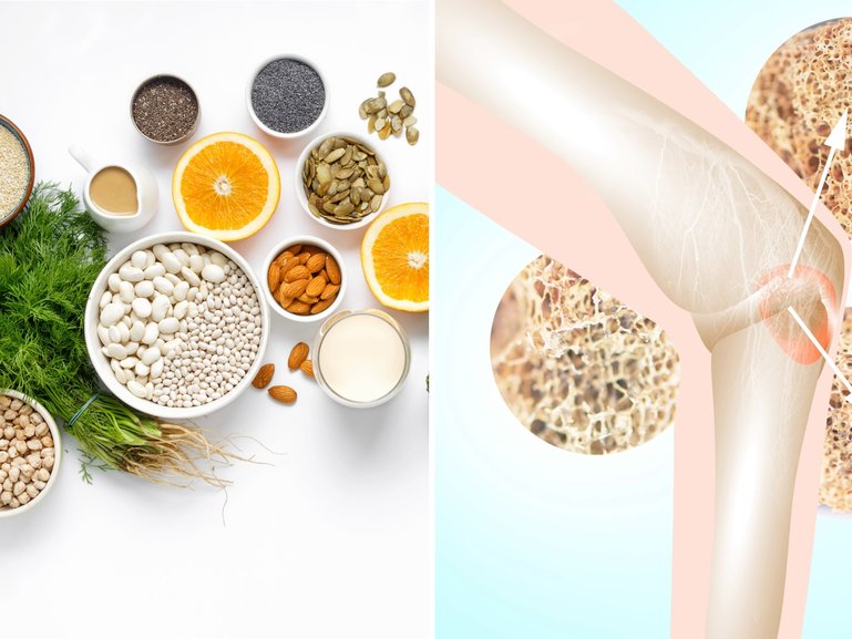 Sarah Di Lorenzo's advice on what foods to eat to boost bone density.